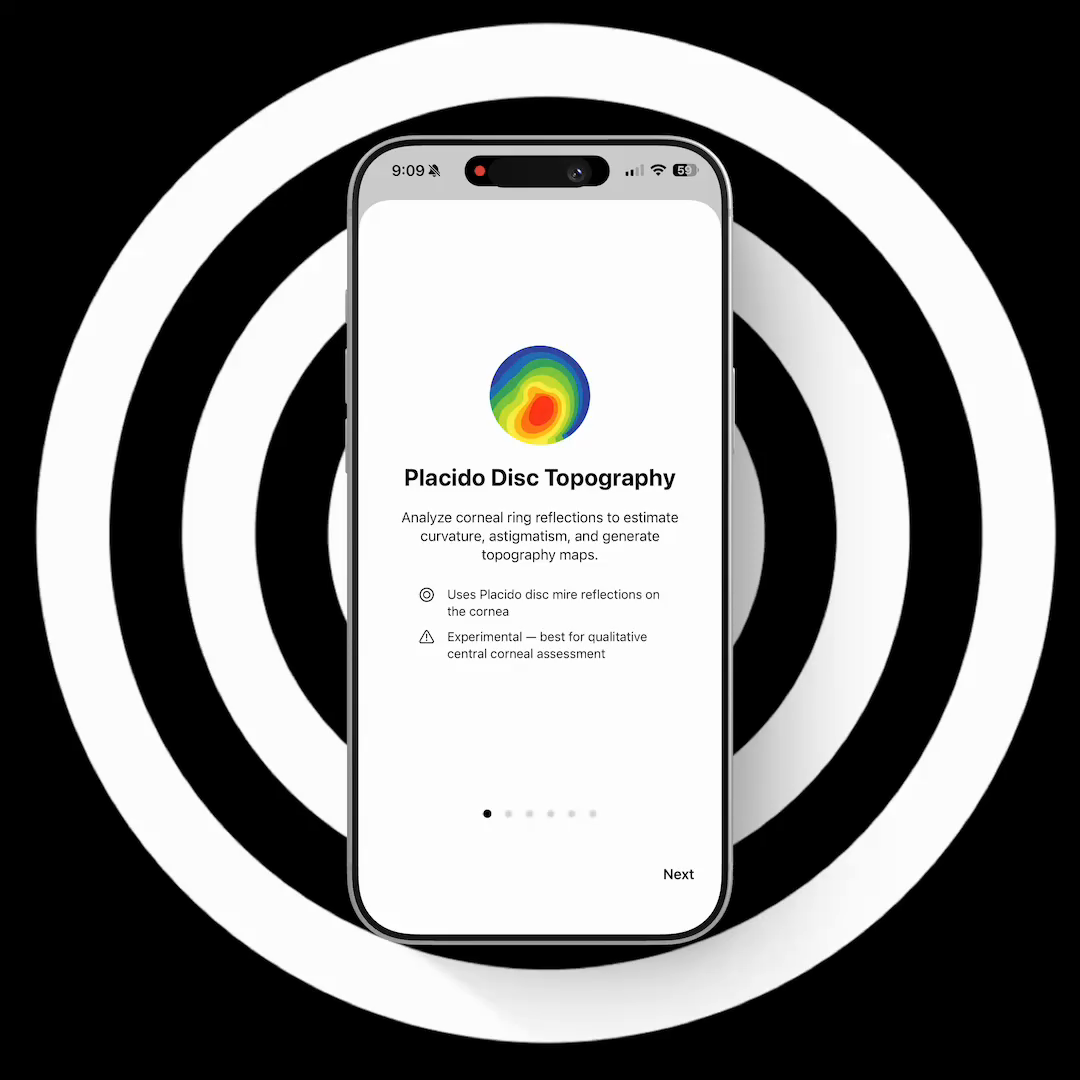 Corneal Topography Map Ophthalmology App