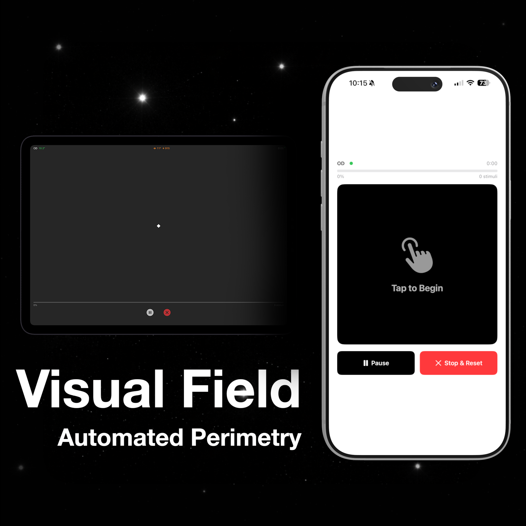 Visual Field Perimetry Test Ophthalmology App